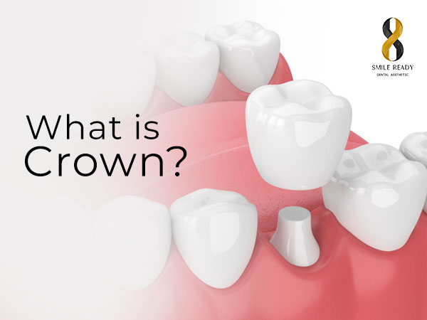 What Is Crown
