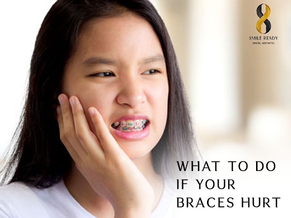 What To Do If Your Braces Hurt?