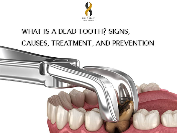 What is a dead tooth? Signs, causes, treatment, and prevention