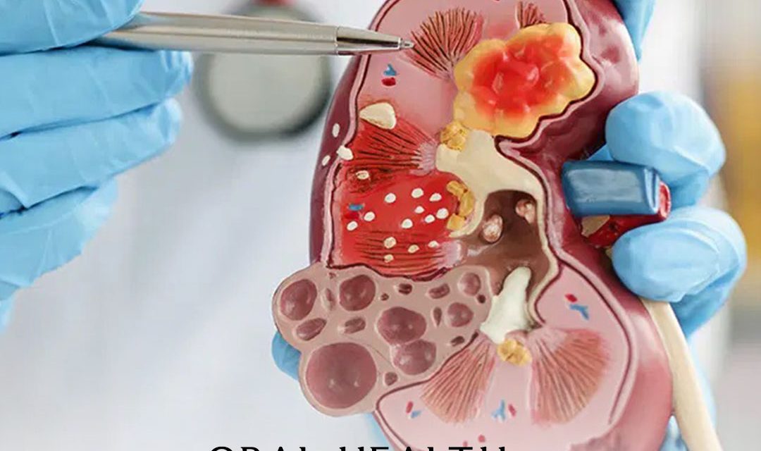The Connection Between Oral Health and Kidney Disease