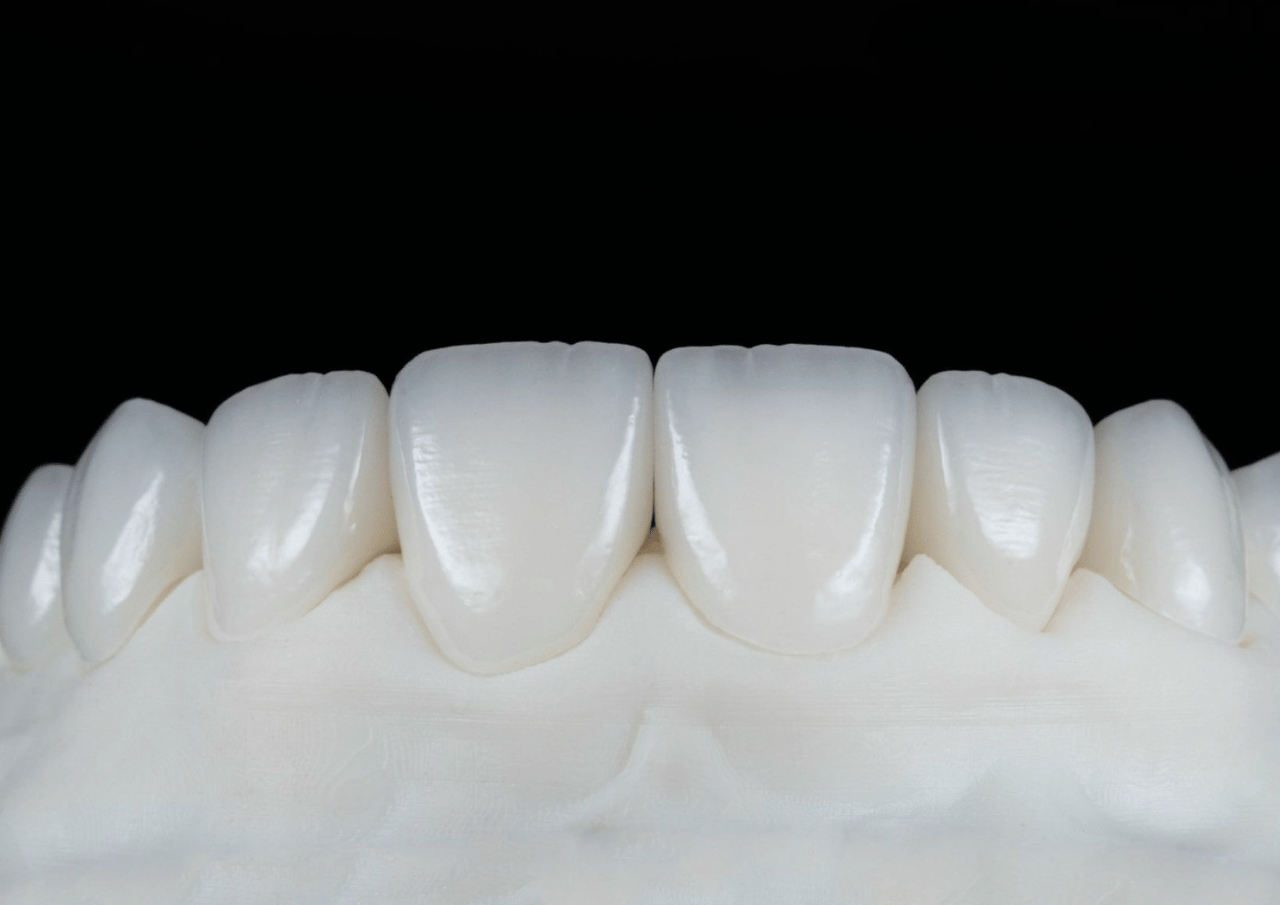 Cosmetic Dental Treatments