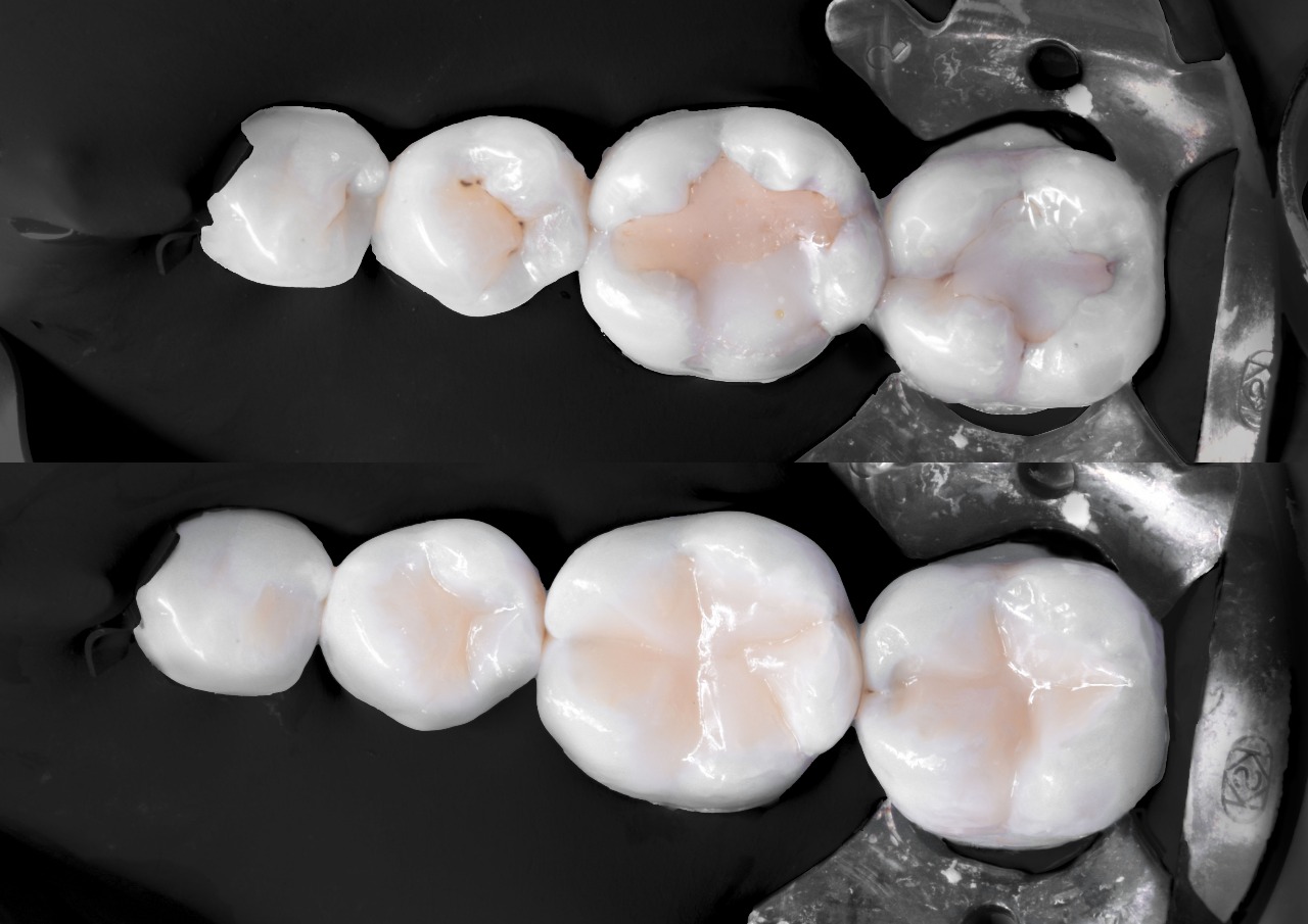 Root Canal and Restorative Treatments
