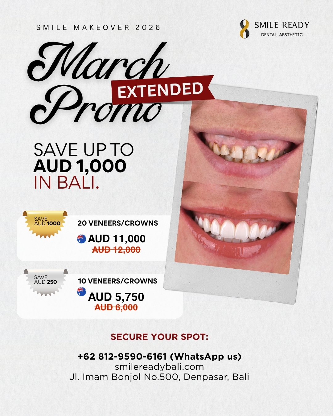 Smile Ready Bali Promo